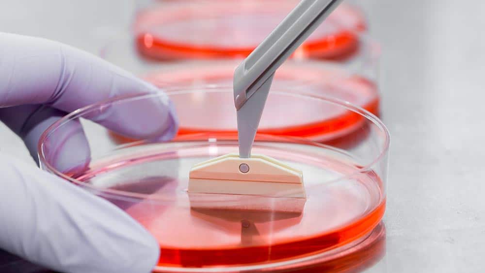 Θεραπεία με Βλαστοκύτταρα